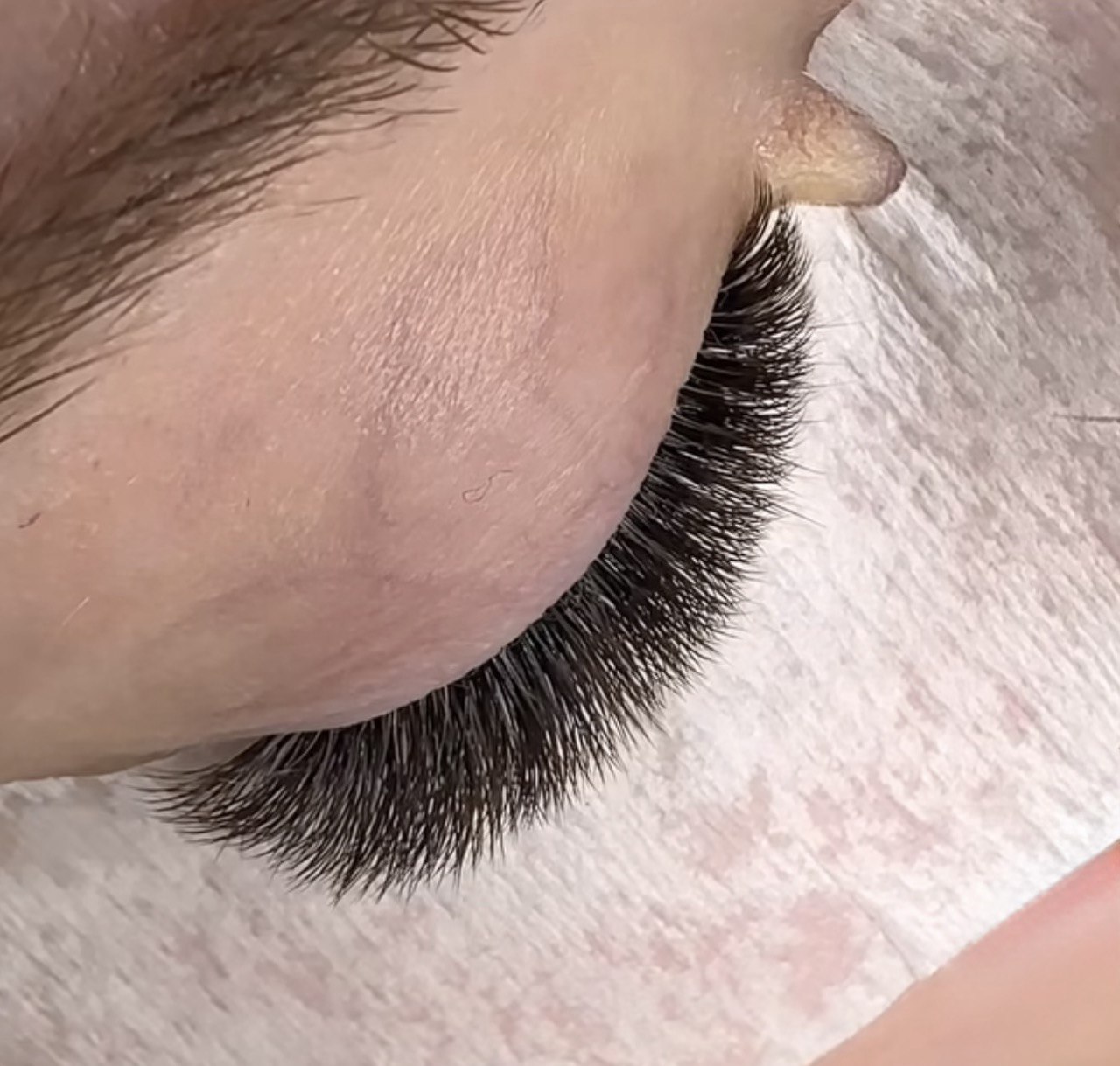 ﻿Lash Removal